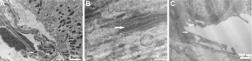 Figure 7 (A) A capillary with intact endothelial lining in the choroid plexus containing two ceria ENM agglomerates (arrows). (B) A vessel in the hippocampus and (C) a vessel from the pituitary gland associated with fine ceria ENM (arrows).Note: Rats were perfused with 100 μg ceria ENM/mL, at a flow rate of 20 mL/minute, and perfusion duration of 120 seconds.Abbreviation: ENM, engineered nanomaterial.