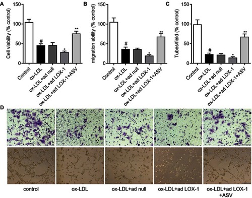 Figure 5 ASV inhibited LOX-1/NLRP3 inflammasome pathway in ox-LDL-induced EPCs. (A) Western blot analysis of LOX-1 in EPCs transfected with adenovirus containing the LOX-1 gene (ad LOX-1) or control adenovirus (ad null). (B) EPCs were transfected with ad null or ad LOX-1 and the expression levels of NLRP3, ASC, caspase1 and mature IL-1β were detected by Western blot. (C) EPCs were treated with 50 μM ox-LDL in the presence or absence of 40 μM ASC, LOX-1 neutralizing antibody (LOX-1 Ab), LOX-1 inhibitor Poly(I) for 24 hrs. The expression levels of NLRP3, ASC, caspase1 and mature IL-1β were detected by Western blot. #P<0.05 vs control group; *P<0.05 vs ox-LDL group; **P<0.01 compared with ox-LDL+10 μM ASV group.