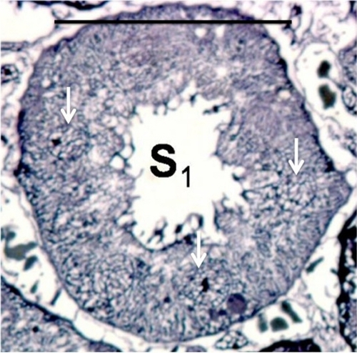 Figure 2B An enlarged region of Figure 2a. Please note the net-like structure in the nuclear content connecting the nucleolus to the nuclear membrane of the S1 cell (see arrows). The scale bar represents 25 μm.