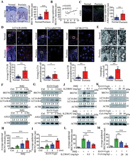 Figure 1. Autophagy-related proteins are functionally active in psoriatic keratinocytes. (A) Expression of the autophagy marker BECN1 in the epidermis of psoriatic patients and normal subjects. Representative immunostaining images of skin (left) and quantification of staining intensity in the epidermis (right). Scale bar: 50 μm. n = 12/group. (B) A significant correlation was found between the average epidermal BECN1 intensities in (A) and the Baker scores of psoriatic lesions (r and p values obtained with Spearman’s rank correlation test). (C and D) Expression of the indicated autophagy markers in the epidermis of psoriatic patients and normal subjects. (C) Representative ATG5 immunostaining images (left) and quantification of staining intensity in the epidermis (right), scale bar: 50 μm, n = 6/group. (D) Representative immunofluorescence of LC3 immunostaining images (top) and quantification of LC3 puncta in the epidermis (bottom, more than 200 epidermal cells were counted each specimen), scale bar: overviews (50 μm) and insets (10 μm), n = 7/group. (E) Representative electron microscopic images of keratinocytes of lesional psoriatic skin and healthy skin (top) and quantiﬁcation of autophagic vacuoles (bottom), more than 10 cells were counted from each specimen. Black arrow, autophagic vacuoles; N, nucleus. Scale bar: 1 µm. (F-I) Expression of autophagy markers in the back skin of the IMQ mouse model (F and H) and the ear skin of the Krt14-Vegfa transgenic mouse model (G and I) at the indicated time points (d: day; mo: month), n = 5/group. (F and G) Representative immunoblots of indicated proteins from skin lysates. (H and I) Quantiﬁcation of immunohistochemical staining intensity of BECN1 in the epidermis. (J-M) Skin autophagy was detected in an IMQ-induced psoriasis mouse model (J and L) and a Krt14-Vegfa transgenic mouse model of psoriasis (K and M) after treatment with therapeutic, recombinant IL23R-FC (0.5 or 1 mg/kg) or cyclosporin A (CsA; 20 or 50 mg/kg), n = 5/group. (J and K) Representative immunoblots of BECN1, LC3A/B-II and ATG5 from skin lysates. (L and M) Quantiﬁcation of immunohistochemical staining intensity of BECN1 in the epidermis. ACTB was detected as a loading control in (F, G, J and K). Mean ± SD. *P < 0.05; **P < 0.01; ***P < 0.001. Two-tailed Student’s T-test (A and C-E). One-way ANOVA (H, I, L and M). All the data are representative of three independent experiments