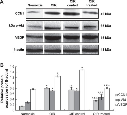Figure 5 CCN1 siRNA inhibited RNV through inhibition of the protein expression in PI3K/Akt–VEGF signaling pathway in the OIR mouse model. (A). Western blot assay for protein expression (B). Statistical analysis.
