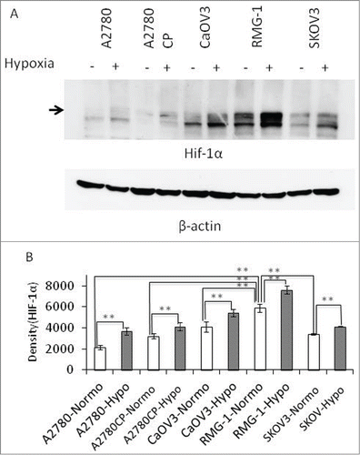 Figure 1. HIF-1α expression in various human ovarian cancer cell lines. Five cell lines, A2780, A2780CP, CaOV3, RMG-1, and SKOV3, were placed in a hypoxic chamber (2% O2, 5% CO2, and 37°C) for 6 h. (A) The cells were lysed and electrophoresed, followed by Western blot analyses using anti-HIF-1α and anti-β-actin Abs. (B) The result in Figure 1A was analyzed densitometrically and processed statistically using JMP software (SAS Institute Inc., Cary, NC). (**: P < 0.01).