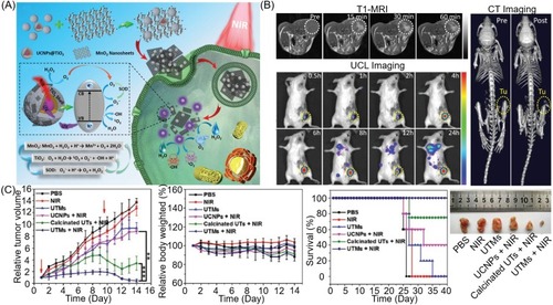 Figure 5 (A) Schematic illustration of (UNCPs)@TiO2@MnO2 NPs for O2 self-supplemented and ROS circulating amplified PDT. (B) T1-MR/UCL/CT imaging of tumors with (UNCPs)@TiO2@MnO2 NPs. (C) The treatment effect of PDT with (UNCPs)@TiO2@MnO2 NPs. Reprinted with permission from Zhang C, Chen WH, Liu LH, Qiu WX, Yu WY, Zhang XZ. An O2 Self-Supplementing and Reactive-Oxygen-Species-Circulating Amplified Nanoplatform via H2O/H2O2 Splitting for Tumor Imaging and Photodynamic Therapy. Advanced Functional Materials. 2017;27(43):1700626.Citation114 Copyright © 2017 John Wiley and Sons.Abbreviations: UCL, upconversion luminescence; UCNPs, upconversion nanoparticles; UTMs, UCNPs@TiO2@MnO2; UTs, UCNPs@TiO2 core–shell–shell nanoparticles.