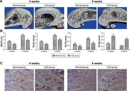 Figure 2 Depression attenuated bone healing in a rat femur defect model.