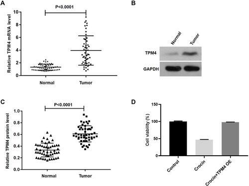 Figure 2 The expression of TPM4 in gastric carcinoma tissues (Tumor) or para-carcinoma tissues (Normal) was verified by qPCR or Western blot. (A) The expression of TPM4 was assessed in gastric carcinoma and para-carcinoma tissues (n=50). (B) Western blot was applied to detect the expression level of TPM4 in cancer tissues and para-carcinoma. (C) Histogram of the TPM4 protein quantification in E normalized to GAPDH. (D) AGS cells were treated with crocin (2.4 mg/mL) for 48 hours after transfecting with TPM4 for 24 hours, the cell viability was measured by CCK-8 assay (n=6). Data are presented as the mean±SD.