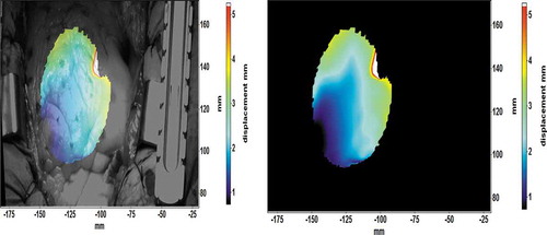 Figure 2. Displacement field map of the heart (a) overlaid on the original image and (b) without the background