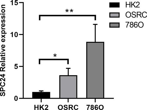 Figure 6 SPC24 is highly up-expressed in ccRCC cell lines. Relative SPC24 expression in ccRCC cell lines (OSRC, 786O) compared with normal cell line (HK2) by RT-qPCR analysis. *P<0.05, **P<0.01.