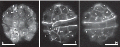 Figs 8–10. Heterocapsa claromecoensis sp. nov. LM images of strain LPCc-005 with UV excitation after calcofluor staining to illustrate plate arrangement. Fig. 8. Cell in ventral view. Note a pore plate (Po), the pore (arrowhead), the sub-circular X plate (arrow). Figs 9, 10. Same cell in two focal planes. Fig. 9. Focus on the ventral side. Fig. 10. Focus on the dorsal side (note that this view is mirror-imaged). Plate labels according to the Kofoidian system. Labels of sulcal plates, as: anterior sulcal, las: left accessory sulcal, lps: left posterior sulcal, rs: right sulcal, ps: posterior sulcal. Scale bars = 10 µm (Figs 8–10)