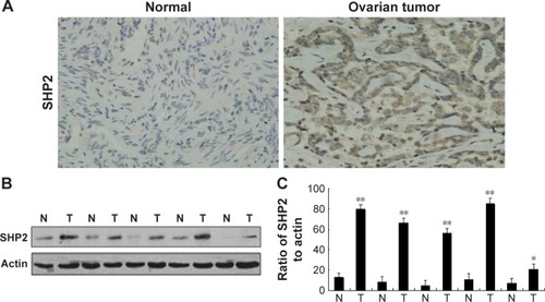 Figure 2 SHP2 overexpression in human ovarian tumor tissues.