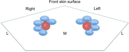 Figure 4 Percentage of variation in anatomical relations between the right and left internal jugular vein (in blue) and common carotid artery (C).