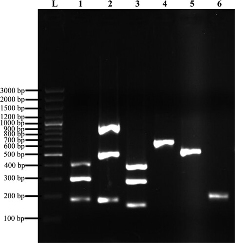 Figure 2. Representation of MSCRAMM genes amplified products on 1% (w/v) agarose gel electrophoresis. Lane L: 100 bp plus molecular weight marker; lane 1: Triplex 1 – cna (423 bp), eno (302 bp), ebps (186 bp); lane 2: Triplex 2 – sasC (936 bp), icaAD (520 bp), icaBC (182 bp); lane 3: Triplex 3 – fib (404 bp), clfA (292 bp), sasG (159 bp); lane 4: fnbA (643 bp); lane 5: fnbB (524 bp); lane 6: clfB (205 bp).