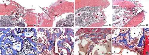 Figure 1. Defect healing in ovariectomized rats after the two-week healing period in SR group (A) and (E), SC group (B) and (F), CC group (C) and (G) and AC group (D) and (H). Hyperplasia of connective-tissue cells (CT), bony callus (BC), implanted Bio-Oss (★), repopulated and integrated Bio-Oss particles in new bone (★), collagen (Col). Up – H&E, 200 μm scale bar; Down – Masson's trichrome, 50 μm scale bar.