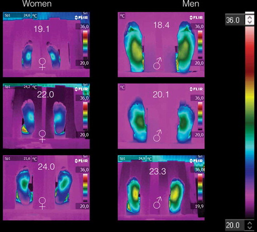 Figure 2. Thermograms of volunteers with BMI < 25 kg/m2. Three main characteristics are shown: (1) symmetry, i.e., the temperature distribution on the right feet is almost the mirror image of those of the left feet. (2) The medial longitudinal arch is the hotter part of the plantar skin for both women and men. (3) The temperature decreases distally from the medial longitudinal arch to the periphery.
