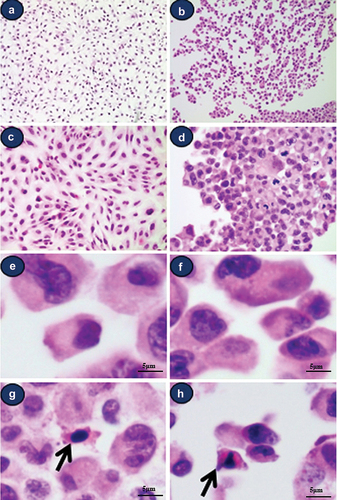 Figure 1. Light micrographic findings of attached and isolated Beas-2B cells (H&E staining). (a) low-power view of attached cells. Small whirlings are noted (magnification 100х), (b) low-power view of isolated cells. Various sized cells and nuclear chromasia are noted(magnification 100х), (c) high-power view of attached cells (magnification 200х), (d) high-power view of trypsinized-isolated cells (magnification 200х), (e) large to medium sized type a cells with single and euchromatic nuclei with abundant cytoplasm, (f) medium- to small-sized type a cells with single and euchromatic or hyperchromatic nuclei, (g, h) small-type B cells with hyperchromatic nuclei with scanty dense reddish cytoplasm (arrow).