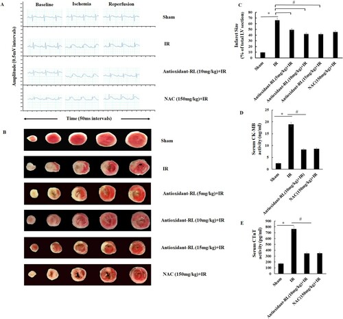 Figure 2. Antioxidant-RL reduces myocardial IR injury in rats. (A) ST-segment elevation was the most important indicator of LAD branch of coronary artery occlusion. ST-segment was elevated after the occlusion of LAD but reduced after LAD recanalization. No significant difference was observed between the groups. (B) Antioxidant-RL (5, 10, and 15 mg/kg) and NAC (150 mg/kg) reduced the infarct size, as evident from TTC staining, in rats subjected to ischemia reperfusion (IR) injury. The white regions represent the infracted area. Data are presented as mean ± SD (n = 5). (C and D) Antioxidant-RL lowered the plasma concentrations of CK-MB and CTnT in different groups. *P < 0.05 represents significant differences between IR and Sham group; #P < 0.05 represents significant difference between antioxidant-RL + IR versus IR group.