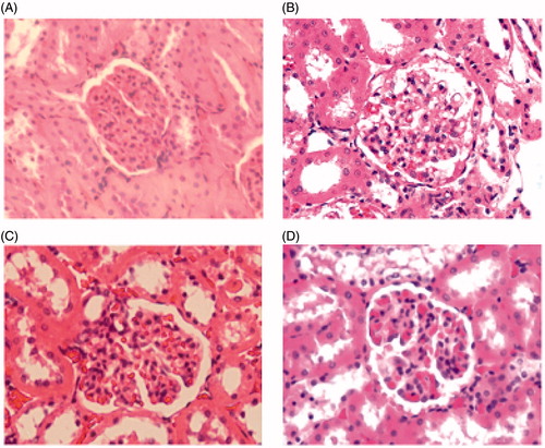 Figure 2. Histopathological photomicrographs of rat kidney sections (40×).