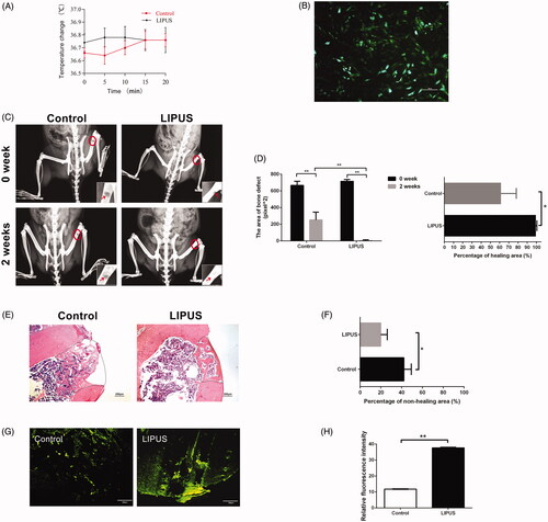 Figure 2. (A) Temperature change in the medium during LIPUS treatment. (B) BMSCs were successfully labelled with GFP. (C) Bone healing was detected using X-ray. The red circle indicates the bone defect. The round defect was closed in the treatment of injection BMSCs pretreated with LIPUS at the end of week two while part of the defect was still not completely closed undergoing only BMSCs treatment. (D) Quantitative analysis of bone defect area in LIPUS group and control group. *p < .05 and **p < .01. (E) H&E cross section of bone defect (40×). Scale bar = 200 μm. Dotted frame indicates the area of bone defect. (F) Quantitative histomorphological analysis of non-healing area on H&E cross section. (G) New bone tissue sections were observed under a fluorescence microscope (100×). Scale bar = 200 μm. (H) Relative fluorescence intensity of bone defect. *p < .05 and **p < .01.