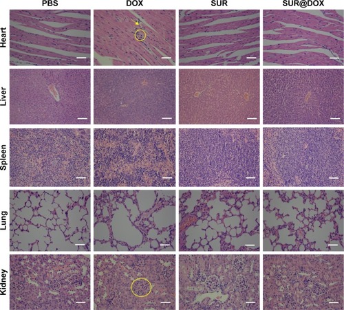 Figure 7 H&E staining assay of major organs and tumors at the end of tumor growth inhibition studies.Notes: Yellow arrows and rings in the heart and kidney sections of free DOX-treated mice indicate severe toxicity. Scale bar: 200 μm.Abbreviations: DOX, doxorubicin; SUR, surfactin; DOX@SUR, DOX-loaded surfactin.