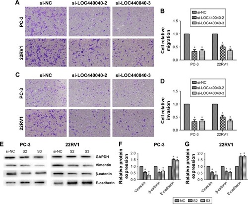 Figure 5 Effects of LOC440040 knockdown on PCa cell migration and invasion.