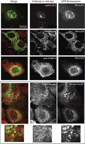 Figure 4.  Colocalization of the GFP chimeric NS4B mutants with intracellular markers. Huh7 cells expressing the 70N, 95N or 161-261N GFP chimeras were fixed and mounted directly on coverslips or stained for Golgi with the anti-GTL2 mAb (10 μg/ml), for NS4B with the anti-NS4B-N (2.6 ng/ml), or for ER with the anti-calnexin pAb followed by the anti-mouse Alexa546 or the anti-rabbit Alexa546 pAbs respectively. Mitochondria were labeled by incubation with the MitoTracker Orange CMTMRs (30 min, 37°C, 50 ng/ml). Representative confocal microscopy images are shown in black and white. Details at the bottom represent 2× magnifications of the framed areas shown in panels above. A colour version of this figure with merged images of the two colours shown on the left is published in Molecular Membrane Biology online.