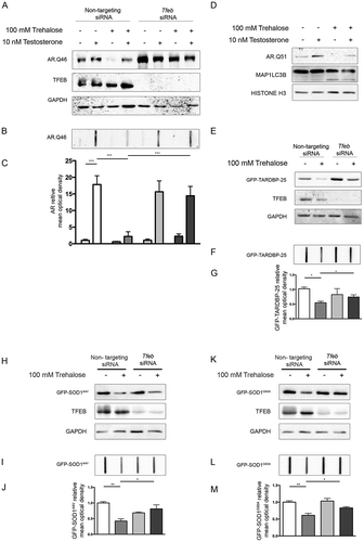 Figure 3. TFEB silencing counteracts trehalose-induced pro-degradative effects. (a-c) NSC34 cells were transfected with Tfeb siRNA or non-targeting siRNAs, and with AR.Q46, untreated or treated with 100 mM trehalose, in absence or in presence of 10 nM testosterone for 48 h. (a) WB analysis and (b) FRA were performed. (c) The bar graph represents the mean relative optical density of FRA ± SD for n = 3 independent samples (*** p < 0.001, two-way ANOVA with Bonferroni’s test). (d) WB analysis on iPSCs derived from SBMA patient (Q51) and differentiated to motoneuronal-like cells for 10 days in absence or in presence of 10 nM testosterone, and treated with 100 mM trehalose for the last 48 h. WB blot analysis was performed. Histone H3 was used for loading control. (e-g) NSC34 cells were transfected with Tfeb siRNA or non-targeting siRNA, and with GFP-TARDBP-25 for 48 h, untreated or treated with 100 mM trehalose for 48 h (e) WB analysis and (f) FRA were performed. (g)The bar graph represents the mean relative optical density of FRA ± SD for n = 3 independent samples (*p < 0.05, two-way ANOVA with Bonferroni’s test). (h-m) NSC34 cells were transfected with Tfeb siRNA or non-targeting siRNA, and with mutant GFP-SOD1 (SOD1A4V and G93A), for 48 h, untreated or treated with 100 mM trehalose for 48 h. WB analysis (h, k) and FRA were performed (i,l). (j,m) The bar graphs represent the mean relative optical density of FRA ± SD for n = 3 independent samples (*p < 0.05, two-way ANOVA with Bonferroni’s test). For WB experiments, GAPDH was used as an internal loading control.