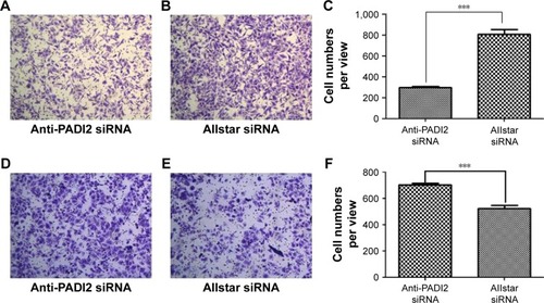 Figure 6 Migration of MNK-45 and Bel-7402 cells treated with anti-PADI2 siRNA, as measured by the transwell migration assay.