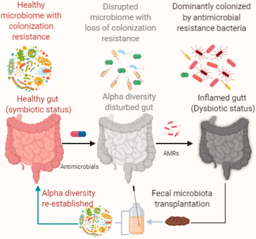 Figure 1. Concept illustration of colonization resistance due to alpha diversity of gut microbes and the effect of antimicrobials in destabilization of symbiotic stage. The disturbed gut microbiota could be colonized with AMRs and leads to dysbiosis. FMT is an alternative therapeutic modality to restore the alpha diversity by decolonizing AMRs.