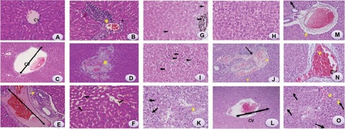 Figure 3 Light microphotographs of liver tissue.Notes: (A) Male rats injected with Milli-Q water for 48 hours demonstrating normal histologic architecture. Hematoxylin and eosin, 400×. (B) Male rats 24 hours postexposure to titanium oxide nanoparticles (252 mg per animal) by intraperitoneal administration demonstrating lymphocytic infiltration (*) in the hepatic portal space. Hematoxylin and eosin, 400×. (C) Male rats 24 hours post-exposure to titanium oxide nanoparticles (252 mg per animal) by a single oral administration demonstrating marked dilatation of central vein. Hematoxylin and eosin, 400×. (D) Male rats 24 hours post-exposure to titanium oxide nanoparticles (252 mg per animal) by intraperitoneal administration demonstrating marked necrosis (*) and scattered hemorrhages. Hematoxylin and eosin, 400×. (E) Male rats 24 hours post-exposure to titanium oxide nanoparticles (252 mg per animal) by intraperitoneal administration demonstrating dilatation of congested portal vein with edema (*) around the blood vessel in the portal triad. Hematoxylin and eosin, 400×. (F) Male rats 24 hours post-exposure to titanium oxide nanoparticles (252 mg per animal) by intraperitoneal administration demonstrating dilatation and congestion of blood sinusoids (arrows) and binucleation of hepatocytes (circles). Hematoxylin and eosin, 400×. (G) Male rats 48 hours post-exposure to titanium oxide nanoparticles (252 mg per animal) by intraperitoneal administration demonstrating swelling of hepatocytes (arrows) and presence of nanoparticle beneath the capsule (*). Hematoxylin and eosin, 400×. (H) Male rats 48 hours post-exposure to titanium oxide nanoparticles (252 mg per animal) by intraperitoneal administration demonstrating vacuolization of hepatocytes. Hematoxylin and eosin, 400×. (I) Male rats 48 hours post-exposure to titanium oxide nanoparticles (252 mg per animal) by intraperitoneal administration, hydropic degeneration (ballooning) of hepatocytes and presence of nanoparticle in blood sinusoids (arrows). Hematoxylin and eosin, 400×. (J) Male rats 24 hours post-exposure to titanium oxide nanoparticles (126 mg per animal) by intraperitoneal administration demonstrating dilatation of congested portal vein with hemorrhage and edema (*) around the blood vessel and lymphocytic infiltration (arrow) in the portal triad. Hematoxylin and eosin, 400×. (K) Male rats 24 hours post-exposure to titanium oxide nanoparticles (126 mg per animal) by intraperitoneal administration demonstrating focal necrosis (*) and hydropic degeneration of hepatocytes (arrows). Hematoxylin and eosin, 400×. (L) Male rats 48 hours post-exposure to titanium oxide nanoparticles (126 mg per animal) by intraperitoneal administration demonstrating marked dilatation of congested central vein. Hematoxylin and eosin, 400×. (M) Male rats 48 hours post-exposure to titanium oxide nanoparticles (126 mg per animal) by intraperitoneal administration demonstrating dilatation of congested portal vein with edema (*) around the blood vessel in the portal triad. Hematoxylin and eosin, 400×. (N) Male rats 24 hours post-exposure to titanium oxide nanoparticles (63 mg per animal) by intraperitoneal administration demonstrating marked dilatation of congested central vein. Hematoxylin and eosin, 400×. (O) Male rats 48 hours post-exposure to titanium oxide nanoparticles (63 mg per animal) by intraperitoneal administration demonstrating focal necrosis (*) and hydropic degeneration of hepatocytes (arrows). Hematoxylin and eosin, 400×.