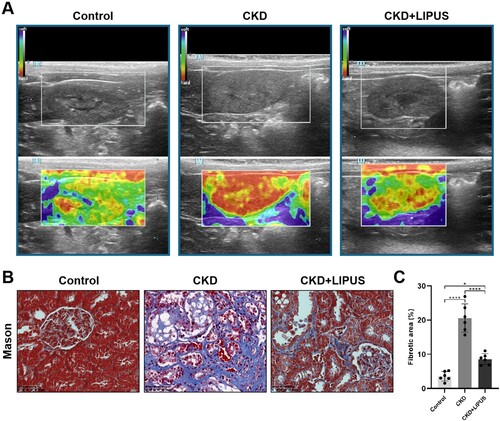 Figure 3. Treatment with LIPUS ameliorated kidney hardness and renal fibrosis in the ADR-induced CKD rat. (A) Representative elastic map of each group on the classical ultrasound image in coronal views. The elastic map is colour-coded from 0 to 45 kPa, with red representing the hardest, yellow representing relatively hard, green representing relatively soft, and blue represents the softest. (B) Representative micrographs of Masson’s trichrome staining in each group. Scale bar, 50 μm. (C) Quantification of fibrotic area, expressed as a percentage of the total area. Data represent the mean ± standard error of the mean (SEM) for 6 rats in each group. *p < 0.05, **** p < 0.0001.