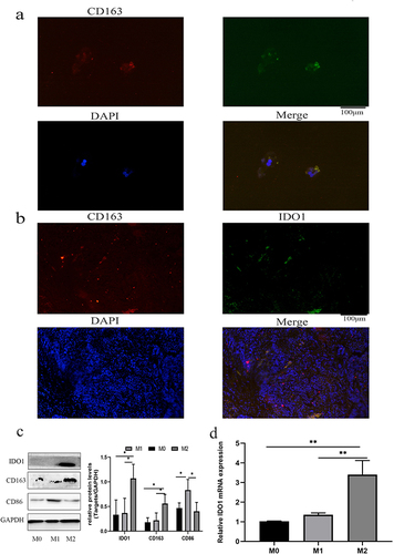 Figure 3 Verification of the relationship between the expression of IDO1 and M2 macrophages. (a) The IDO1 protein labeled with green fluorescence and the CD163 protein labeled with red fluorescence colocalized in the cytoplasm of M2 macrophages. (b) The colocalization of IDO1 (green) and CD163 (red) in tissue sections of NSCLC patients as shown by immunofluorescence. (c and d) The protein and mRNA expression levels of IDO1 and CD163 in M2 macrophages were higher than those in M0 macrophages (magnification, 20-x) (**p<0.01; *p<0.05).