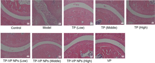 Figure 7. Effect of TP-VP NPs on joint histopathological changes.