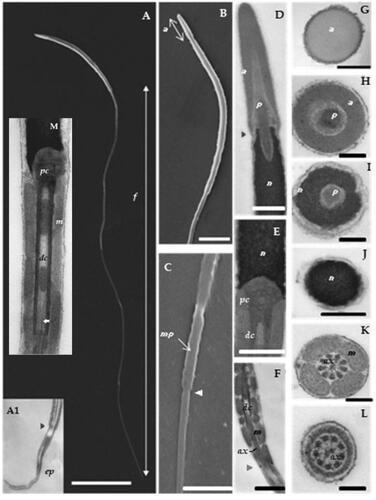 Figure 1. The common pheasant spermatozoon ultrastructure: SEM images (A–C) and TEM images of longitudinal sections (A1, D–F, M) and transversal sections (G–L). (A) general view of the spermatozoon (scale bar = 10 µm); (A1) TEM micrograph of the endpiece. (B) acrosome and sperm head (scale bar = 1.5 µm). (C) part of the flagellum with the midpiece (scale bar = 1 µm). (D) acrosomal region and anterior part of the nucleus (scale bar = 0.5 µm). (E) nucleus base and centriolar region (scale bar = 500 nm). (F) the midpiece with the mitochondria (scale bar = 1 µm). (G) acrosomal region (scale bar = 200 nm). (H) acrosome and perforatorium section (scale bar = 200 nm). (I) perforatorium and nucleus section (scale bar = 200 nm). (J) nucleus section (scale bar = 500 nm). (K) midpiece section with mitochondria and axoneme (scale bar = 200 nm). (L) principal piece section (scale bar = 200 nm). (M) centriolar region. f = flagellum; ep = endpiece; a = acrosome; mp = midpiece; p = perforatorium; n = nucleus; pc = proximal centriole; dc = distal centriole; m = mitochondria; axe = axoneme.