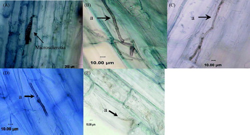 Figure 2. Microstructure in the roots of E. wushanense plants inoculated with different DSE strains. (A) Microsclerotia in cortical cells ×400; (B) resynthesis treatment inoculated with the DSE8 strain; (C) resynthesis treatment inoculated with the DSE10 strain; (D) resynthesis treatment inoculated with the DSE5 strain; (E) resynthesis treatment inoculated with the DSE2 strain; (a) melanized hyphae.