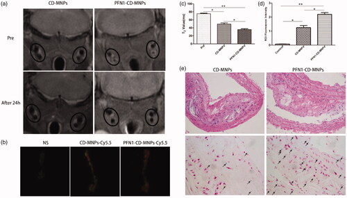 Figure 5. In vivo MRI and ex vivo NIRF of ApoE−/− mice with PFN1-CD-MNPs. (a, b) Representative in vivo MR images (a) and ex vivo fluorescence images (b) obtained before and 24 h after the administration of PFN1-CD-MNPs in ApoE−/− mice. (c,d) Quantification of MRI T2 values in carotid artery (c) and aorta fluorescence intensity (d) before and 24 h after the administration of PFN1-CD-MNPs. (e) Iron deposition in plaque was validated through histological H&E staining (upper panel) and Prussian blue staining (lower panel) (*p< .05, **p< .01).