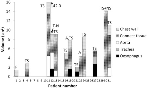 Figure 2. Violated maximum OAR constraints for all patients in the study group individually. The absolute volume receiving 70/74 Gy is shown for each organ. For patient 11, 42 cm3 of aorta, CTi and chest wall received doses above 74 Gy. The reason for overdosage is indicated. TS: tumour shrinkage; NS: node shrinkage; A: atelectasis; T-N: tumour-node shift; P: positioning.