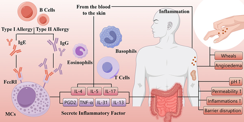 Figure 1. The manifestations and pathophysiology of chronic urticaria.
