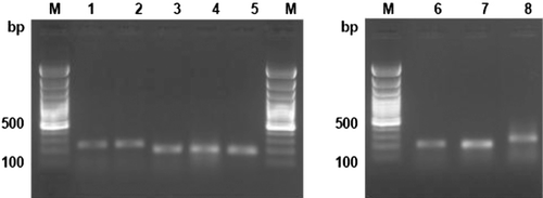 Figure 2. Agarose gel (1.5% w/v) electrophoresis of PCR-amplified products in endometrial tissue of buffaloes Lane M: 100 bp DNA ladder; Lane 1–2: TLR-4 (251 bp); Lane 3–4: CD14 (192 bp); Lane 5: TNF-α (186 bp); Lane 6: IL-1β (205 bp); Lane 7: IL-8 (201 bp); Lane 8: β-actin (214 bp).
