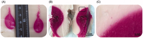 Figure 3. Photographs of cross-sections through the heated volume, as cut along the applicator track in tissue-mimicking thermochromic phantoms after laser and microwave ablation procedures. (A) Colour change after laser ablation. (B) Colour change after microwave ablation. (C) A 7.5-fold magnification of the rectangular region shown in B.