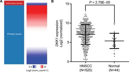 Figure 1 HNSCC tissues have significantly elevated DKK1 expression levels compared with adjacent normal tissues.Note: Heatmap (A) and plot (B) showing DKK1 expression in HNSCC tissue (T=520) and normal tissue (N=44).Abbreviation: HNSCC, head and neck squamous cell carcinoma.
