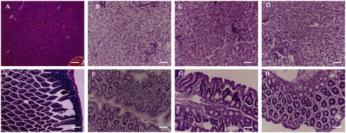 Figure 3. Haematoxylin and eosin (H&E) staining of liver and colon sections (A: liver in normal control (NC); B: liver in model control (MC); C: liver in positive control (PC); D: liver in Jiang-Zhi granule (JZG); E: colon in NC; F: colon in MC; G: colon in PC; H: colon in JZG).