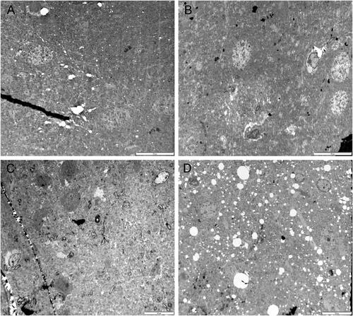 Figure 8. Representative TEM images of the right brain temporal cortex. lobes. Sham control group (A), 900 MHz exposure group (B), 1800 MHz exposure group (C), 2100 MHz exposure group (D). Scale bars = 10 µm (A, B, C, D).