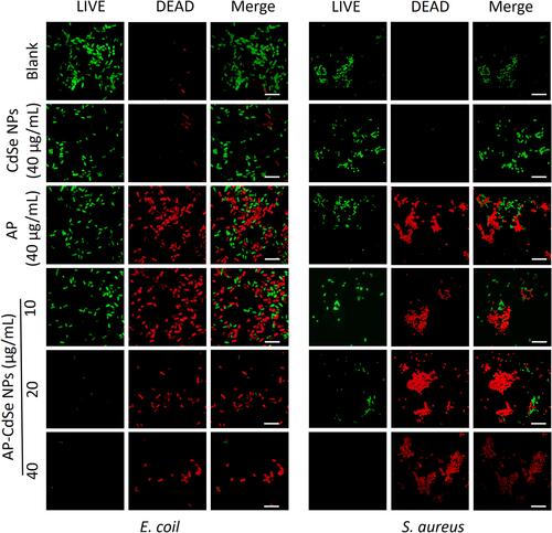 Figure 4 Confocal fluorescence microscopy assay. MDR E. coli and MDR S. aureus, after treatment with AP-CdSe NPs at various concentrations (10, 20, 40 µg/mL). AP solution (40 µg/mL) and CdSe NPs solution (40 µg/mL) were used as control groups. The PBS-treated group was used as blank group. All cells were stained for 30 min with SYTO 9 (green fluorescence) and PI (red fluorescence). Scale bar = 10 μm.