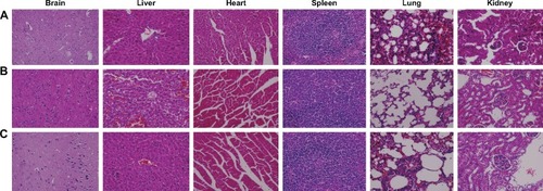 Figure 5 Histological staining of excised organs from healthy BALB/c mice following intravenous administration three times within 24 hours with (A) 0.9 g/dL natrium chloride, (B) drug-free NPs, or (C) Tan IIA-NPs.Note: Representative images of organ sections were at 400× magnification.Abbreviations: NPs, nanoparticles; Tan IIA-NPs, tanshinone IIA liquid NPs.