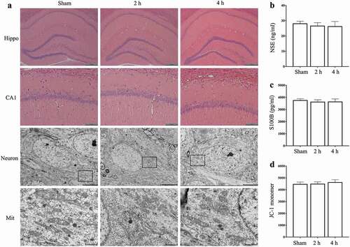 Figure 3. Effects of exposure to microwave on the hippocampal neurons. (A) HE stain and TEM, bar = 400 μm for Hippocampus (Hippo), bar = 100 μm for CA1, bar = 5 μm for Neuron and bar = 1 μm for Mitochondria (Mit), (B) The content of NSE in serum, (C) The content of S100B in serum, (D) The fluorescence intensity of JC-1 monomer in hippocampal neurons.