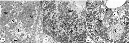 Figure 7. Electron micrographs of a portion of the proximal convoluted tubule: (A) Control group showing that the cell has an euchromatic nucleus (N) with prominent nucleolus, basal infoldings of the cell (arrow) with longitudinally arranged mitochondria (M), apical microvilli (mv), and apical vacuoles (v). (B) Gentamicin treated group showing the cell has a small condensed nucleus (N), loss of basal infoldings, mitochondria (M) with distorted cristae and matrix loss, loss of apical microvilli (mv), the cytoplasm shows the presence of many lysosomes (L) and vacuoles(*). (C) Gentamicin and AGE cotreated group showing that the cell has an euchromatic nucleus (N) with, basal infoldings of the cell (arrow) with mitochondria(M), apical microvilli (mv) and some vacuoles(v) can be noticed (x 4800)