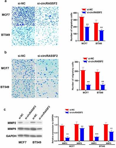 Figure 4. Knockdown of circRASSF2 inhibits migration and invasion of BC cells. (a) The migration ability of different groups of MCF7 and BT549 (si-NC and si-circRASSF2) was detected by Transwell (without matrix glue). (b) The invasive ability of different groups of MCF7 and BT549 (si-NC and si-circRASSF2) was detected by Transwell (with matrix glue). (c) Western blotting assay used to detect the protein levels of MMP2 and MMP9 in different groups of MCF7 and BT549 (si-NC and si-circRASSF2). *, P < 0.05; **, < 0.01; ***, P < 0.001