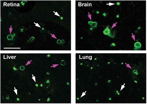 Figure 2. Fluorescence microscopy of enriched autophagosomes. Enriched autophagosomes from retina, brain, liver and lung were imaged by fluorescence microscopy. Red arrows point to ring-shaped vesicular structures, while the white arrows point to smaller, more punctate structures. Scale bar: 2 µm.