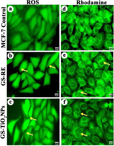 Figure 7. Effects of G. superba rhizome extract and nanotitania catalysts (IC50 concentration) on intracellular ROS generation in treated MCF-7 cells, (a) Control cells, (b, c) rhizome extract and nanotitania catalysts treated cells. Rhodamine mitochondrial staining images of (d) control cells, (e, f) Rhizome extract and nanotitania catalysts exposed cells showed compressed form of mitochondrial membrane The white scale bars are 10 µm.