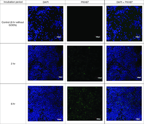 Figure 3. Confocal microscopy of GDEN uptake by RAW 264.7 cells after 2 and 6 h incubation period, magnification of 200×.