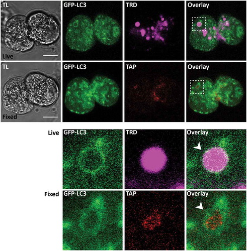 Figure 8. Trypsinogen activation peptide in LC3-coated endocytic vacuoles. The figure shows correlative images of GFP-LC3 fluorescence in live cells and immunofluorescence labeling of trypsinogen activation peptide (TAP) in fixed cells. TL indicates transmitted light images. Scale bars: 10 µm. In these experiments GFP-LC3 (green) PACs were stimulated with 500 pM CCK for 30 min in the presence of TRD (magenta to identify EVs) and imaged live on gridded dishes. They were then fixed with 4% PFA. Immunofluorescence staining for TAP (red) was performed as described in the Materials and Methods section. Correlative images of the same cells are shown: live cells (first (upper) row of images) and fixed cells (second row of images). Cellular region containing the LC3-coated EV is highlighted by dashed boxes on the Overlay images of live and fixed cells; this region is shown on the expanded scale in the 2 bottom rows. White arrowheads point toward the LC3-coated EV. Note co-localization of GFP-LC3 fluorescence with immunostaining for TAP in this organelle.